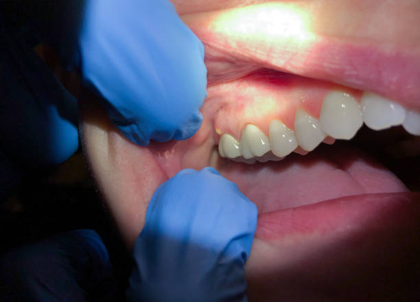 Best Pediatric Emergency Dentist in New Lebanon, OH