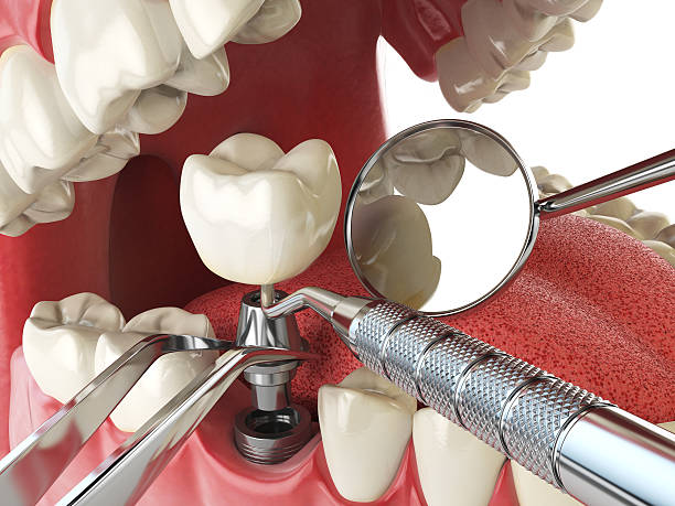 Best Emergency Dentist for Special Needs Patients in New Lebanon, OH
